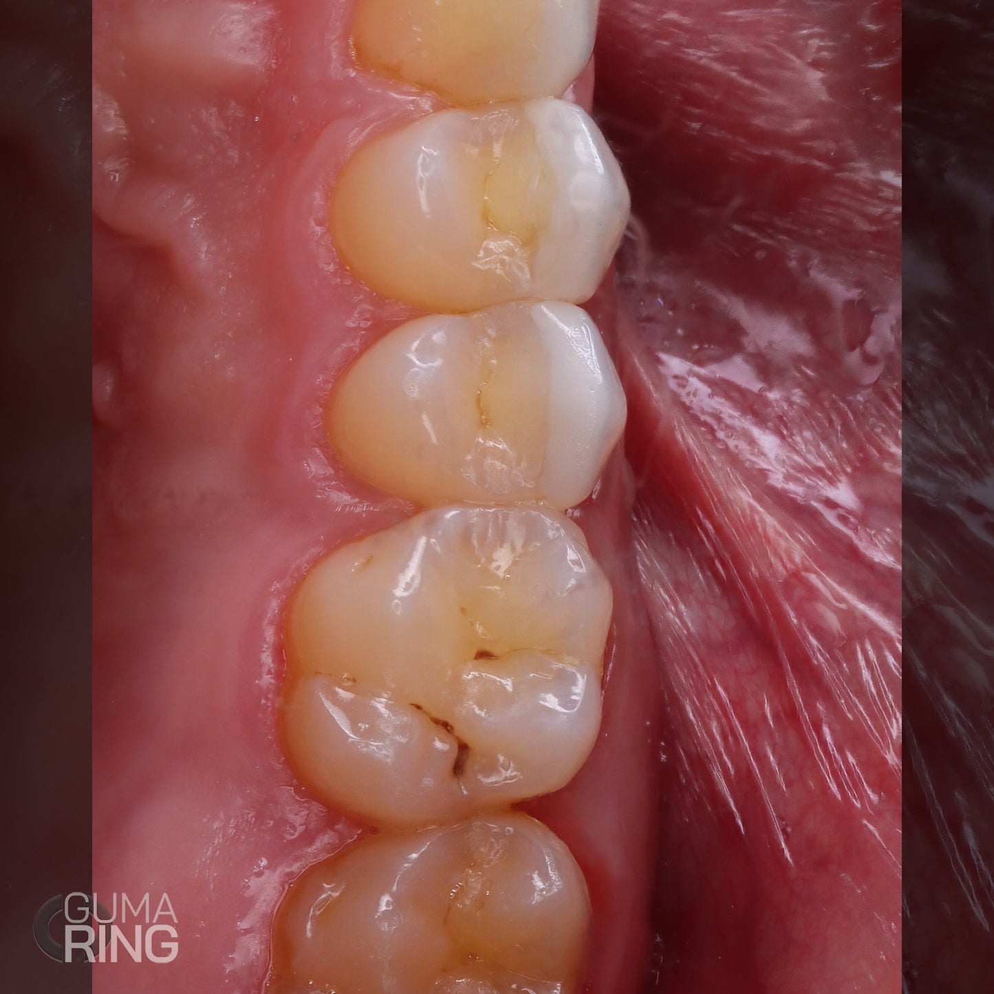 GUMA RING