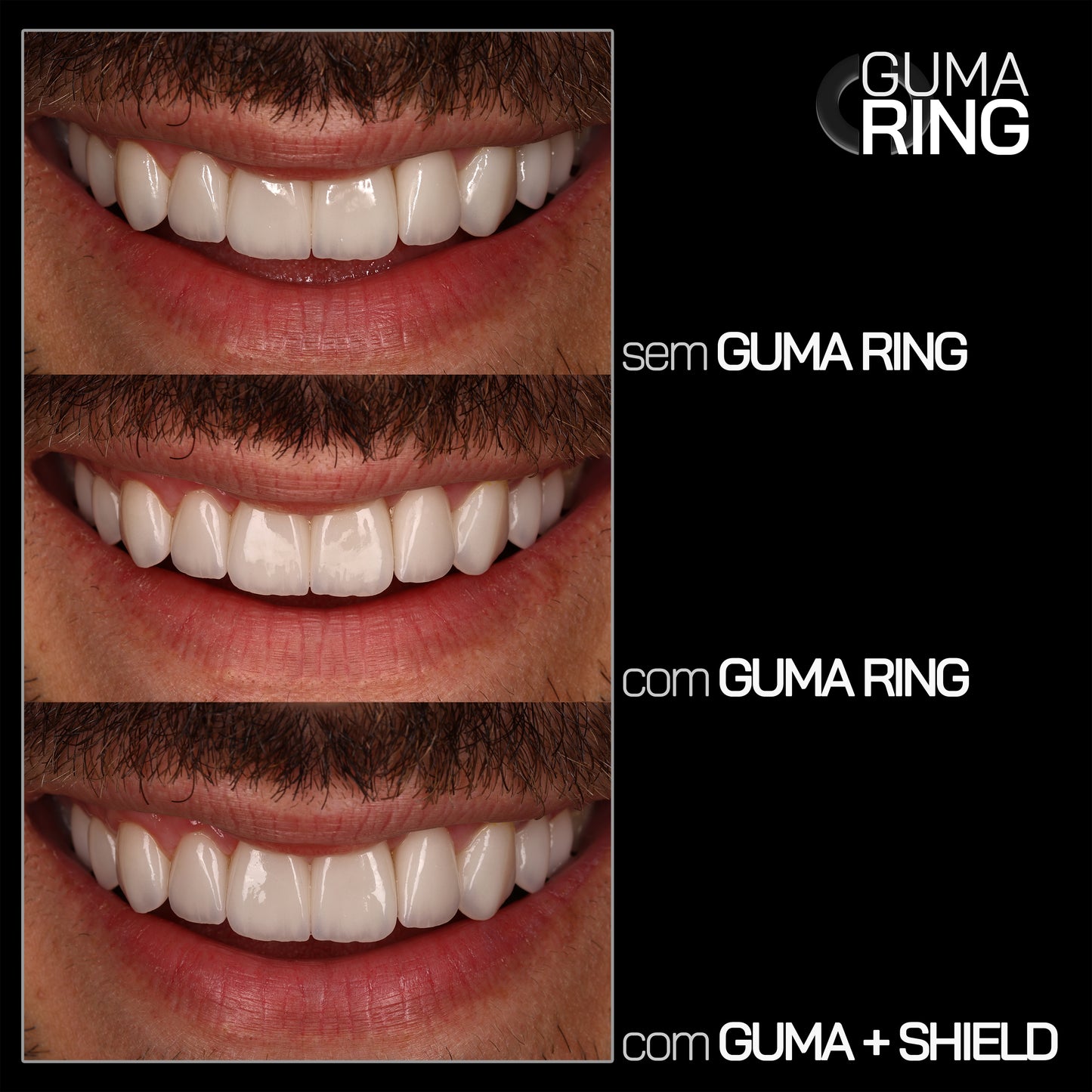 GUMA RING